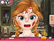 Play Anna Face Problems free online, a doctor game where players treat Princess Anna's facial injuries and give her treatment.