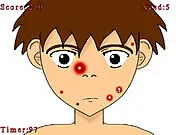 Screenshot of Pimple Madness free online game, showing a character's face with various blemishes ready for popping and cleaning.