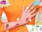 Heal Tori's Hand free online game screenshot, doctor treating an injured hand, surgery simulation game